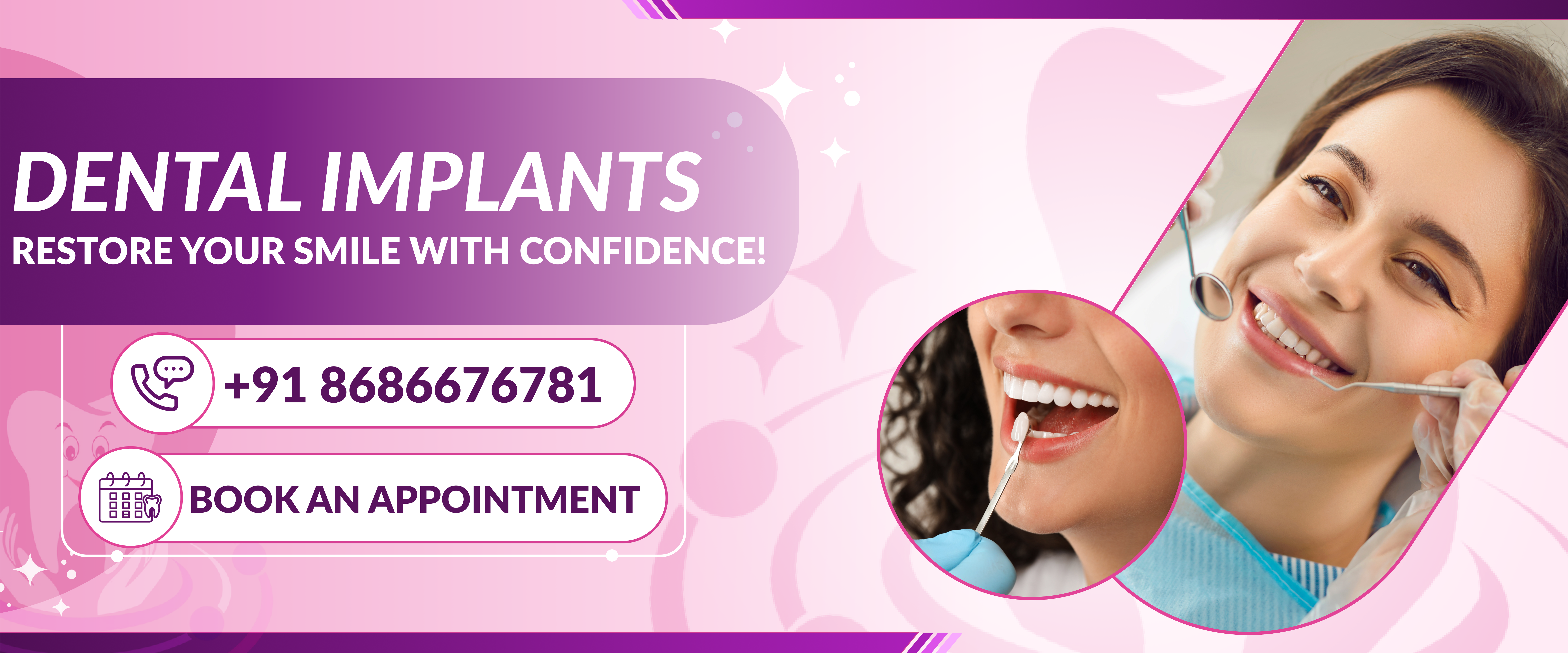 Best Dental Implants in Hyderabad | Galaxy Dental Care