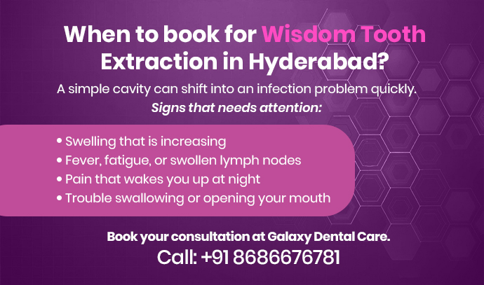 when does a wisdom tooth cavity