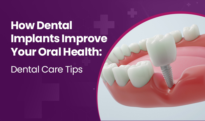 How Dental Implants Improve Your Oral Health: Dental Care Tips