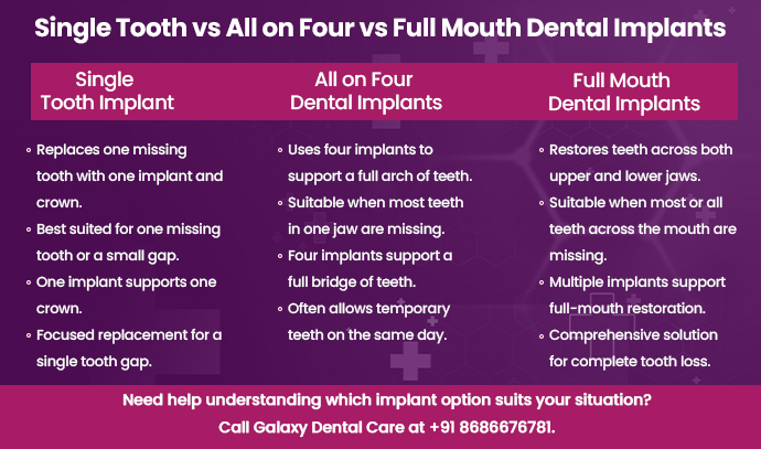 single tooth vs all on four vs full mouth dental implant