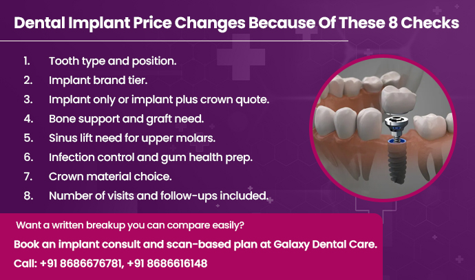 dental implant price changes