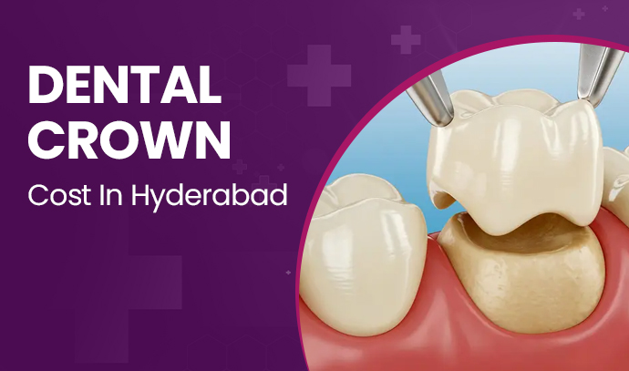 best dental crown cost in hyderabad