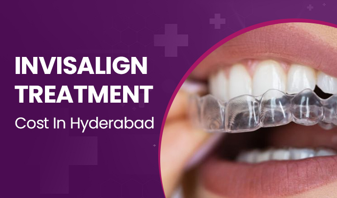 invisalign treatment cost in hyderabad