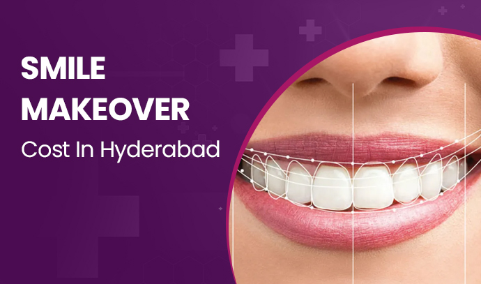 smile makeover cost in hyderabad ind