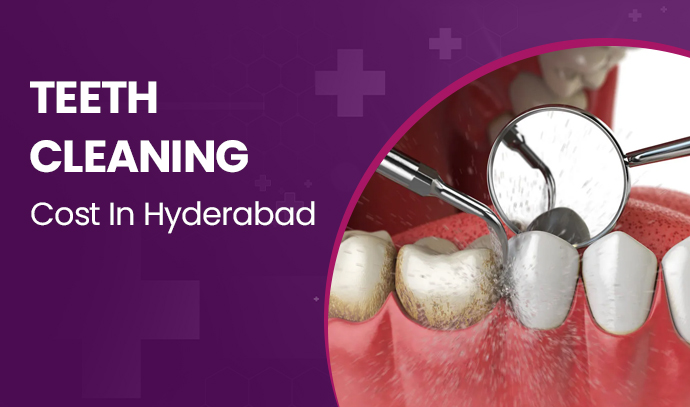 teeth cleaning cost in hyderabad