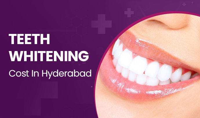 Teeth Whitening Cost In Hyderabad