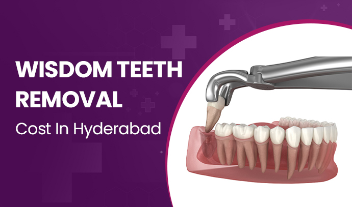 wisdom teeth removal cost in hyderabad