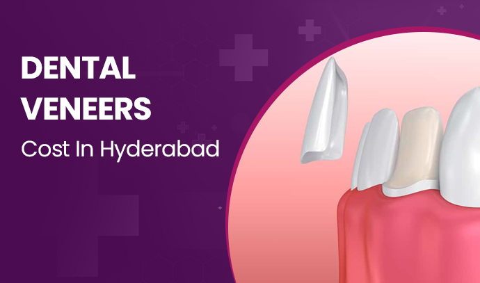 Dental Veneers Cost in Hyderabad