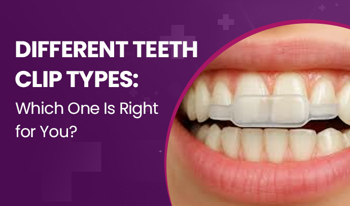 different teeth clip types