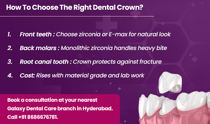 how to choose the right dental crown