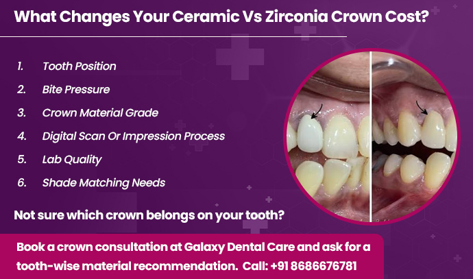 what changes your ceramic vs zirconia crown cost