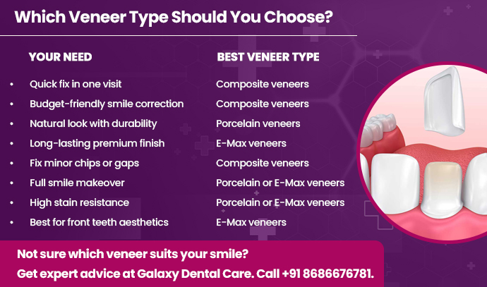which veneer type should you choose