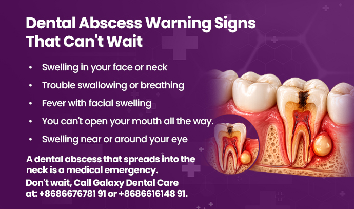 dental abscess warning signs