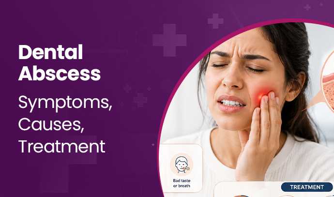 Dental Abscess – Symptoms, Causes, Treatment