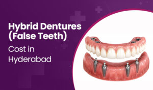 hybrid dentures cost in hyderabad