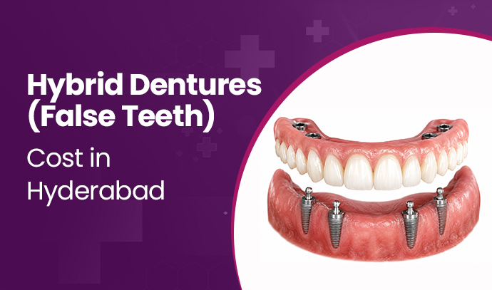 hybrid dentures cost in hyderabad