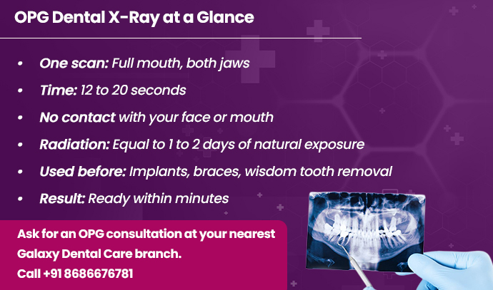 opg dental x ray glance