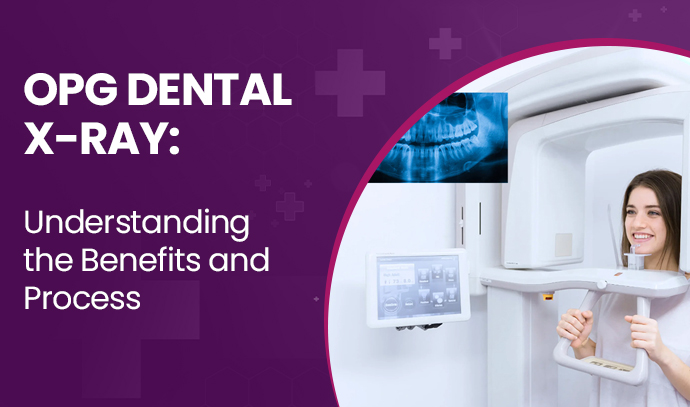 OPG Dental X-Ray: Understanding the Benefits and Process