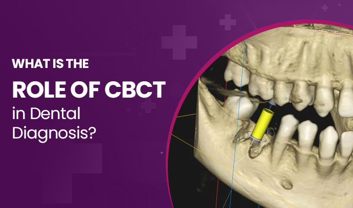 What is the Role of CBCT in Dental Diagnosis?
