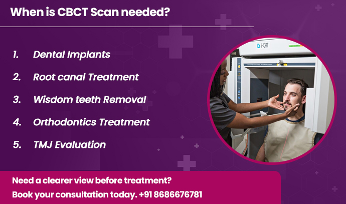 when is cbct scan needed