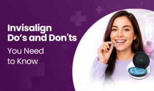 Invisalign dos and dont galaxy