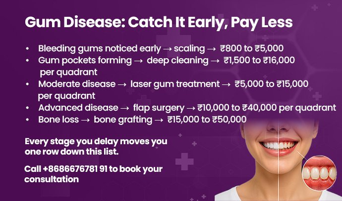 gum disease