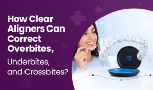 how clear aligners can correct bite