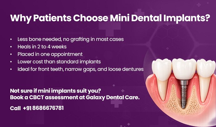 why patients choose mini dental implants