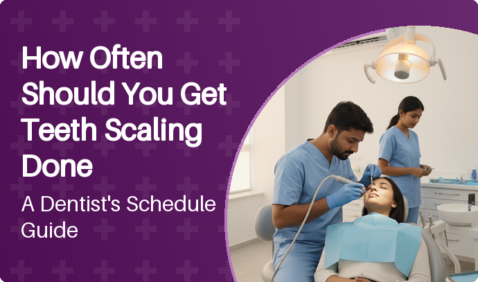 How Often Should You Get Teeth Scaling Done: A Dentist’s Schedule Guide